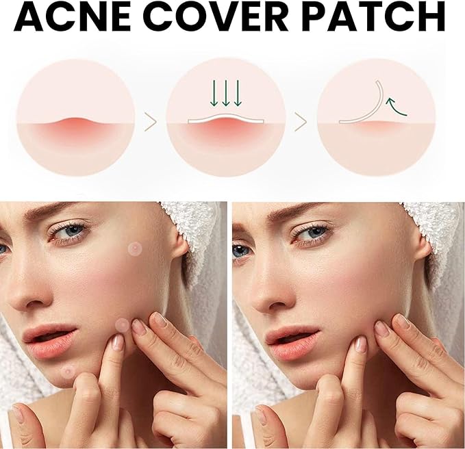 Acne Cover Patch (72 pcs)