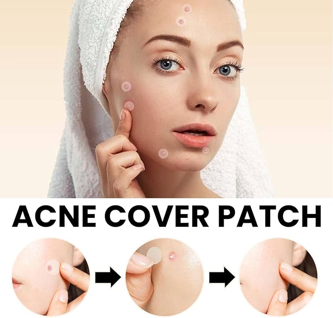 Acne Cover Patch (72 pcs)